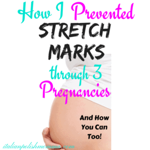 how to prevent stretch marks during pregnancy