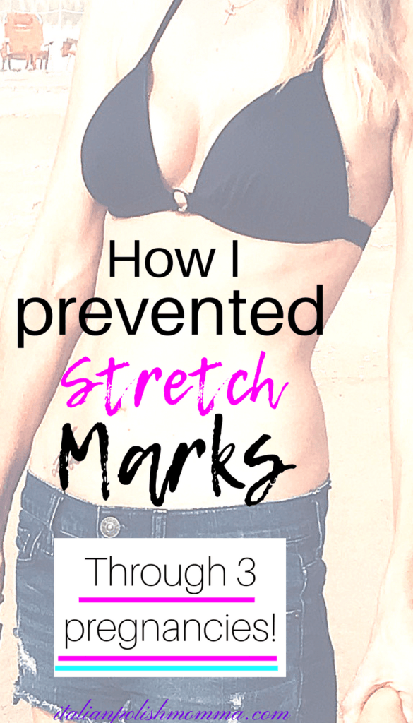 preventing pregnncy stretch marks Prevent stretch marks during pregnancy