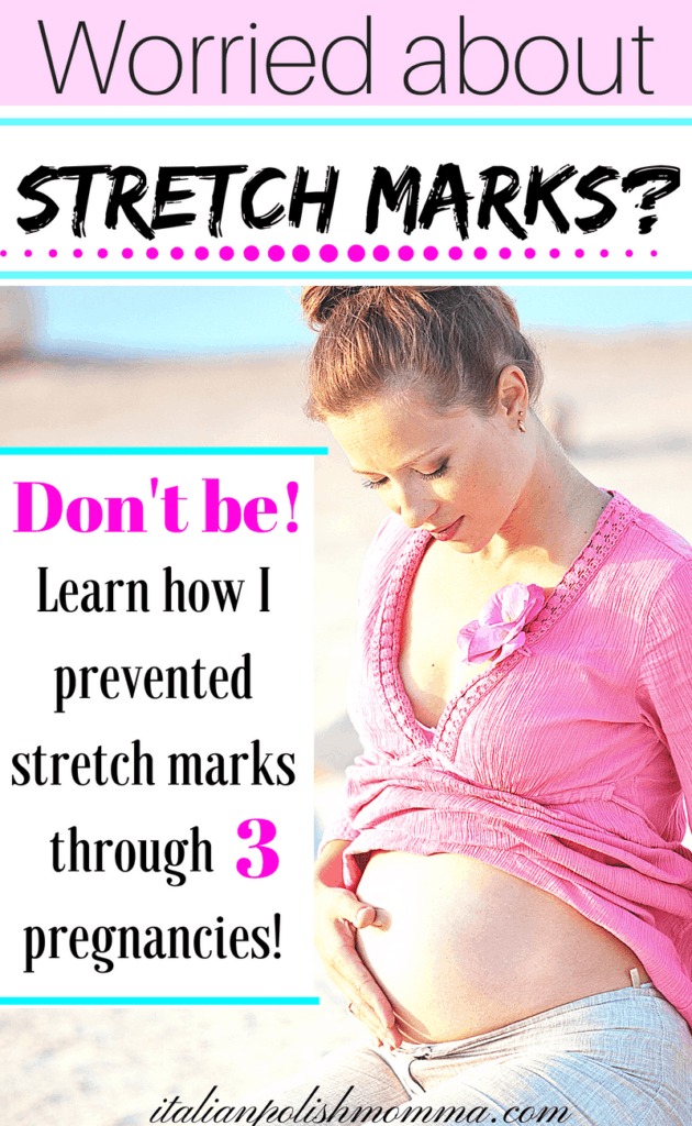 preventing stretch marks during pregnancy