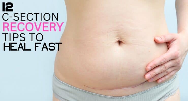 Mom showing how great her c-section scar looks