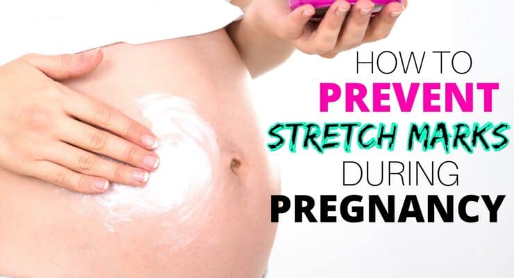 How to prevent stretch marks during pregnancy