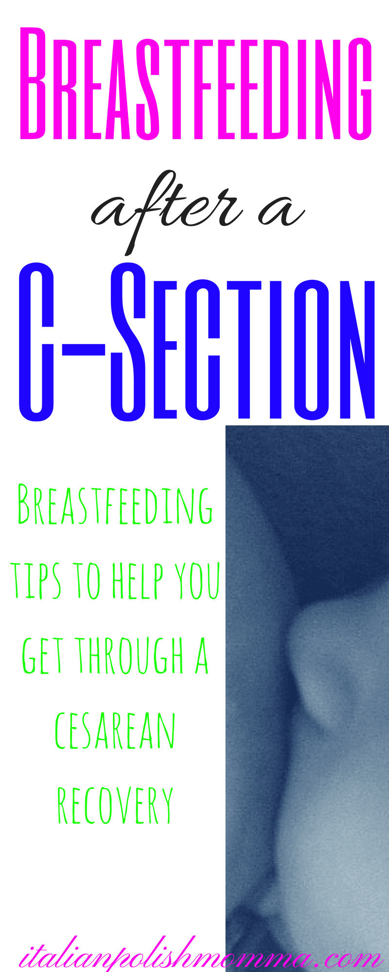 Breastfeeding after a c-section