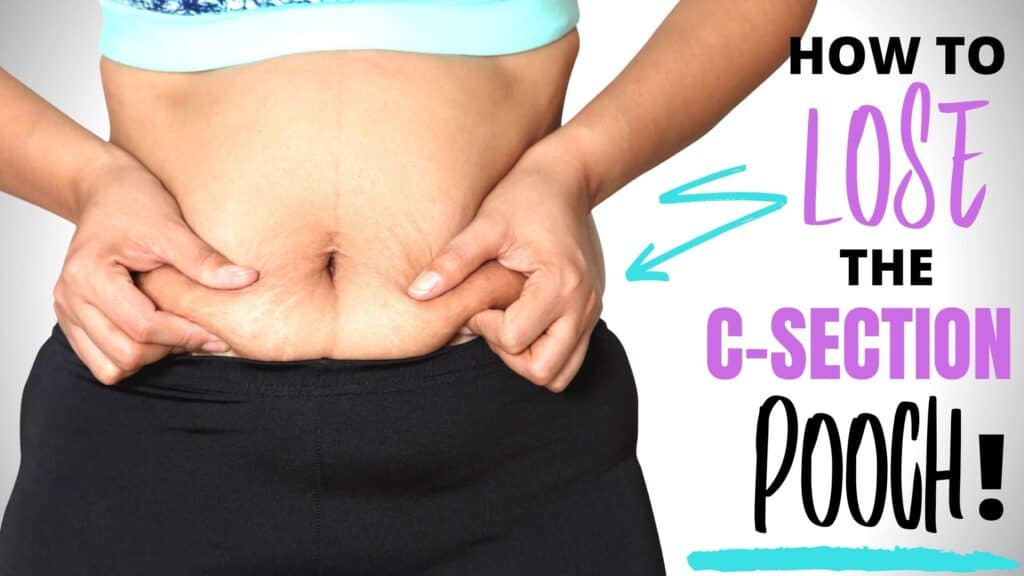 how to lose csection pooch