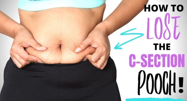 how to lose csection pooch
