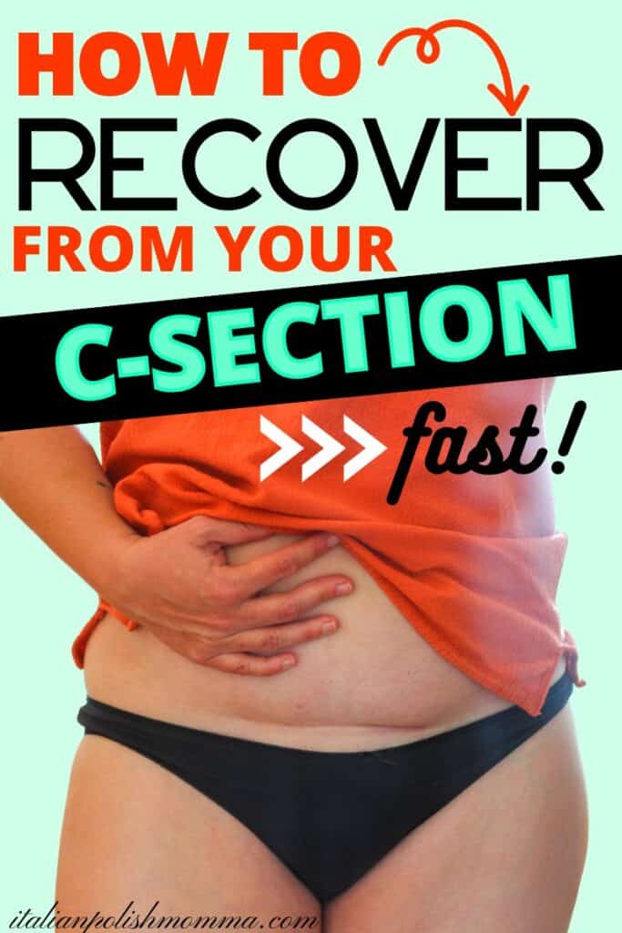 Woman showing her c-section recovery scar
